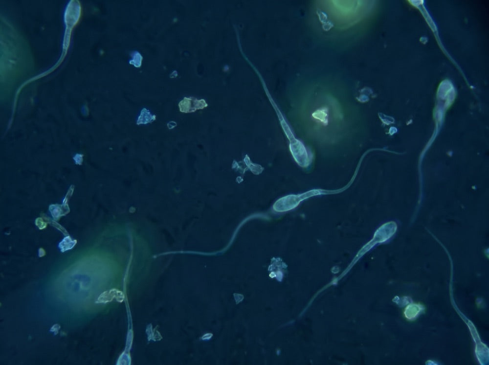 Semen