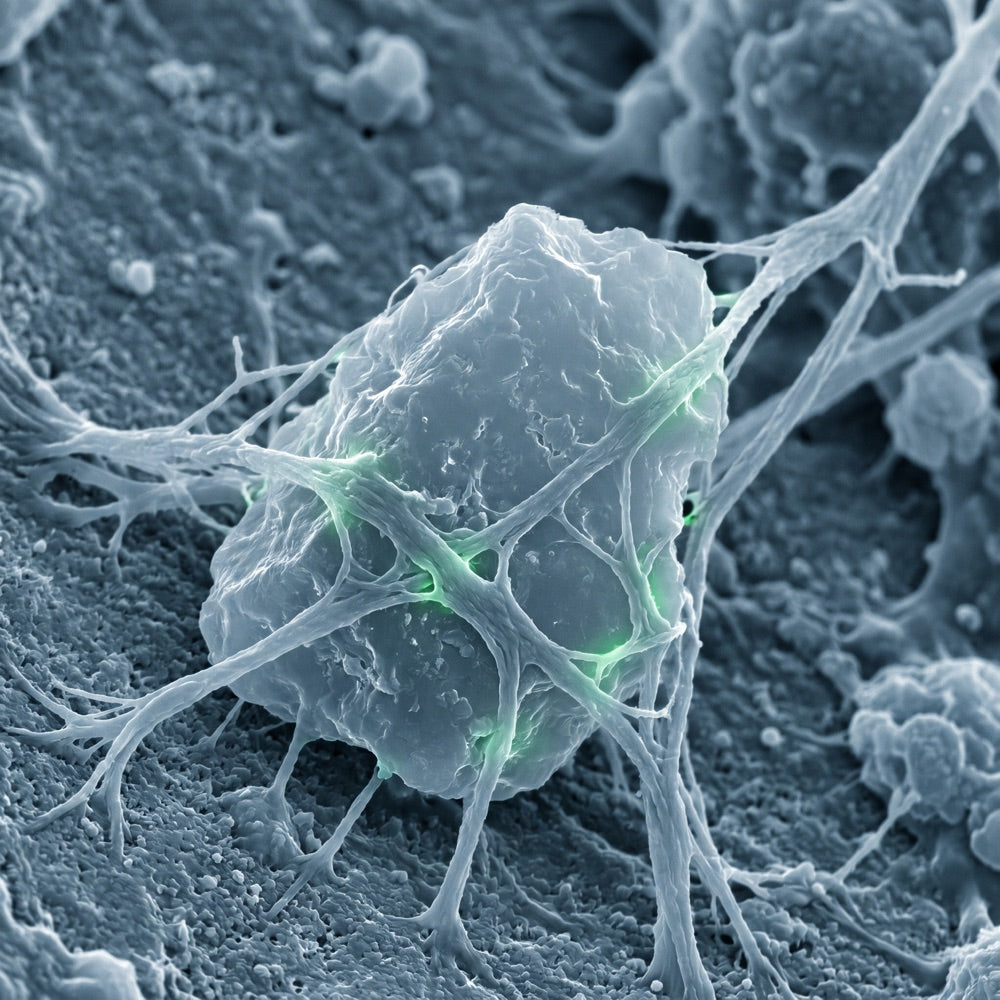 Micrograph: chitosan fibers binding a microplastic particle
